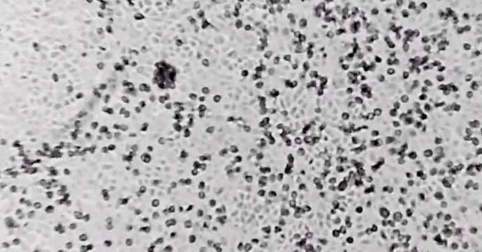 coronavirus