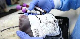 La Puglia inizia la sperimentazione della terapia al plasma contro il Covid-19