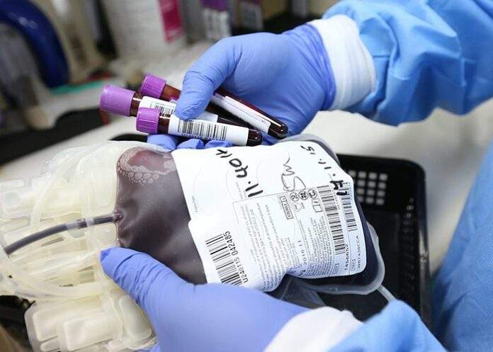 terapia al plasma 2